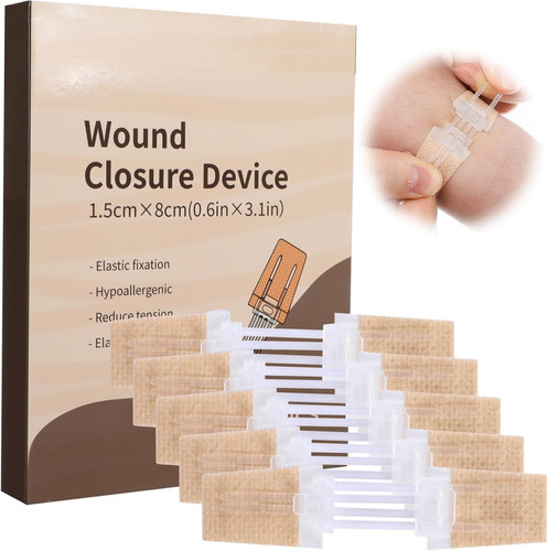 Pack wound closure strips - wound,